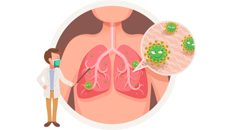 10 biến chứng viêm phổi thường gặp không thể chủ quan1