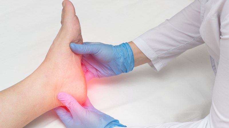 Sưng và tấy đỏ quanh các mô bị viêm ở phía sau gót chân là một trong những dấu hiệu của biến dạng Haglund