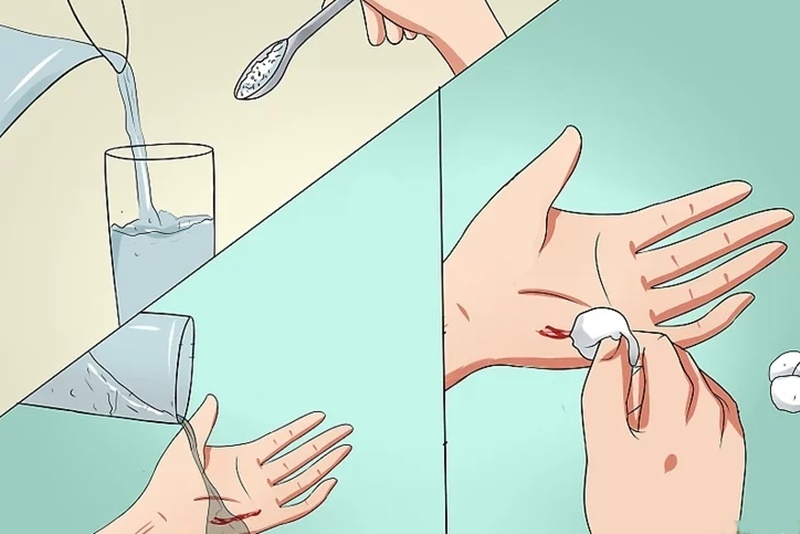 Biện pháp sơ cứu khi bị rắn cắn 2