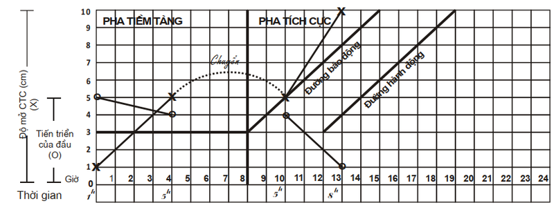 Biểu đồ chuyển dạ là gì? 2