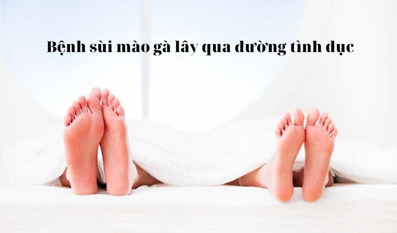 Biểu hiện bệnh sùi mào gà nhẹ ở nam và nữ giới? Biến chứng nguy hiểm?1