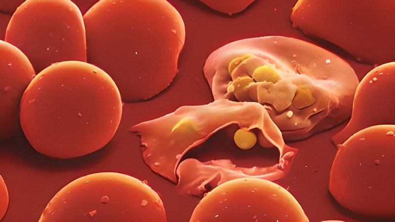 Bilirubin là gì? Tăng bilirubin niệu phản ánh vấn đề gì của sức khỏe? 1