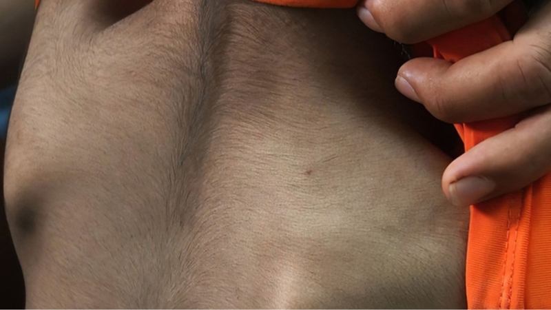 Các thành phần đi kèm biotin làm lông mọc dày và rậm hơn