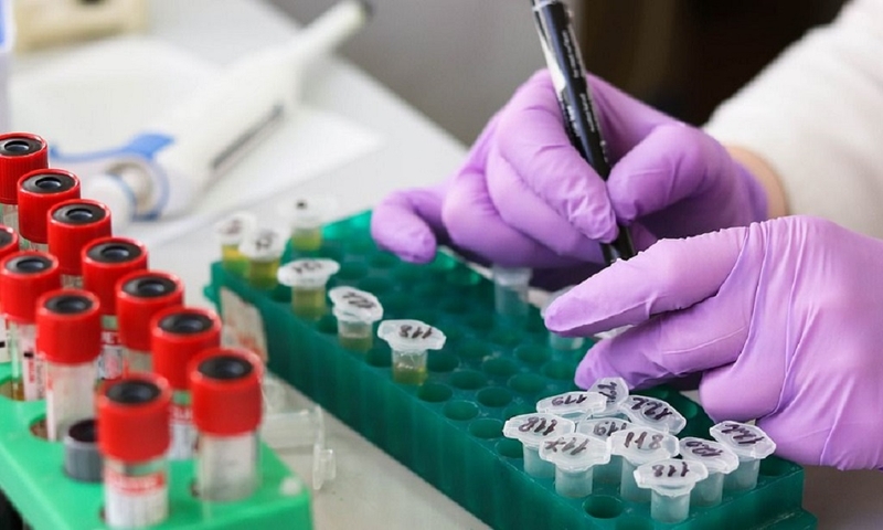 BK là gì? Dấu hiệu nhận biết và phương pháp điều trị cho người bệnh nhiễm BK 4