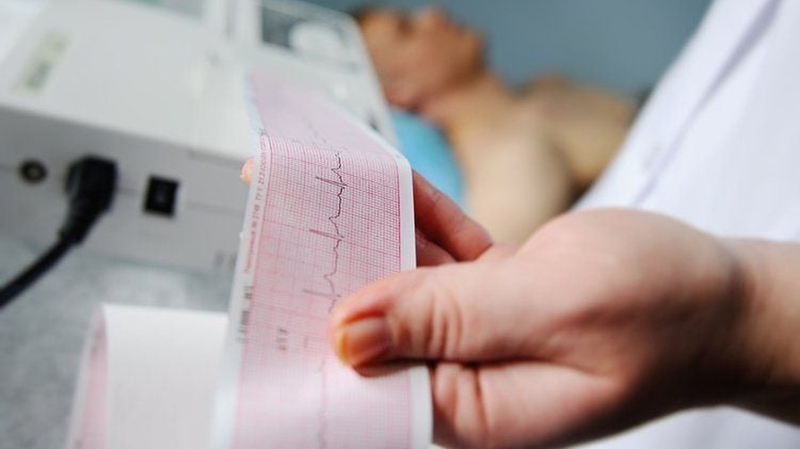 Block xoang nhĩ: Nguyên nhân, triệu chứng và cách điều trị 5