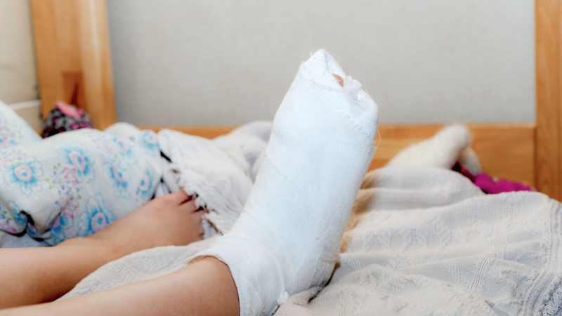 Một số trường hợp cần giữ bất động hoàn toàn lâu hơn trước khi chịu lực