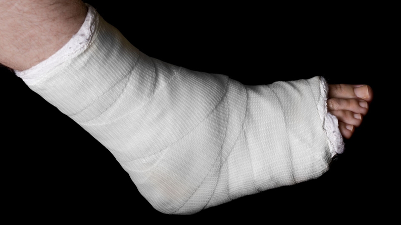 Bó bột được áp dụng trong các trường hợp gãy xương kín, không hoặc ít di lệch