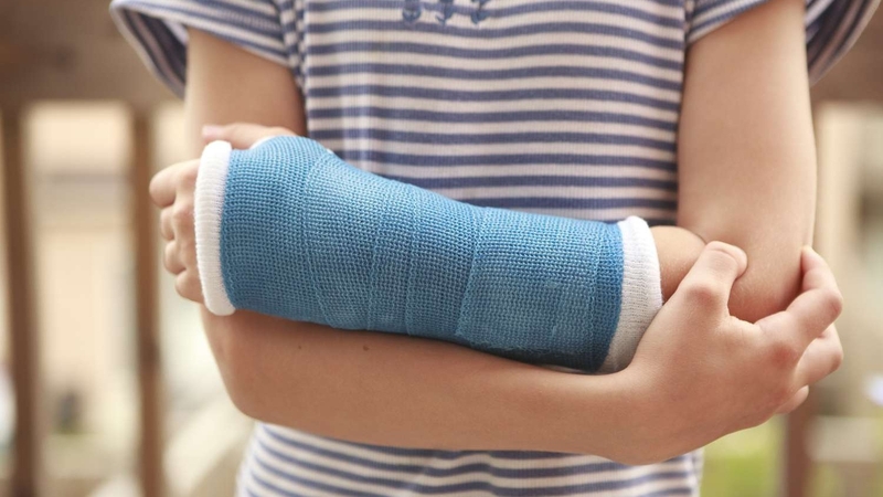 Bó bột là gì? Lưu ý gì khi bó bột 1