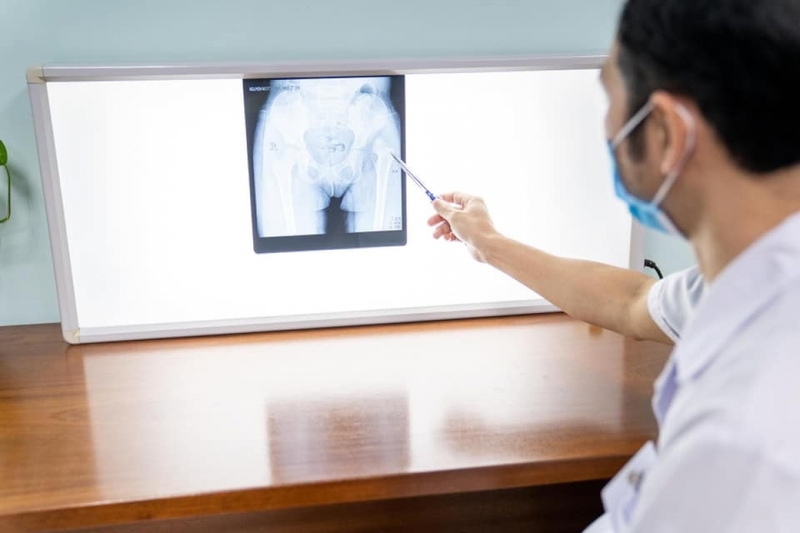 Điều trị trật khớp háng