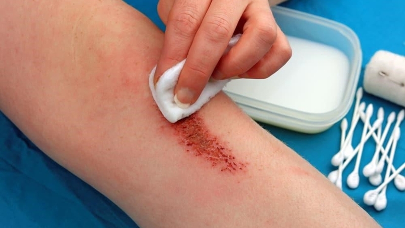 Uống vitamin C bao lâu thì dừng? Cần lưu ý gì để đạt hiệu quả? 1