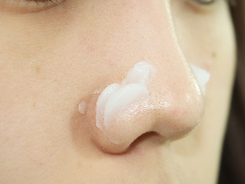 Bỏ túi ngay 04 cách trị mụn cám ở mũi cực hiệu quả 3