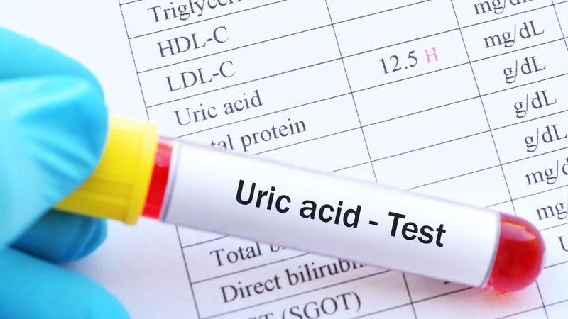 Ở giai đoạn sớm, một số người có thể tăng acid uric máu nhưng chưa xuất hiện biểu hiện lâm sàng