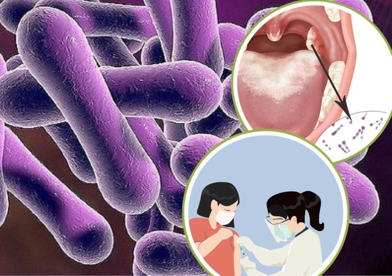 bo-y-te-ha-thap-nguy-co-dich-benh-bach-hau-1 (1).jpg