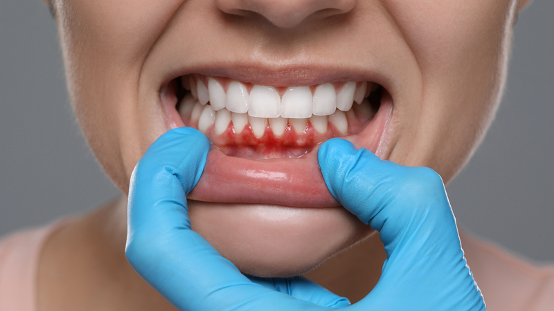 Sốt, mệt mỏi, nôn và tiêu chảy sau khi về từ vùng dịch cần được kiểm tra sớm