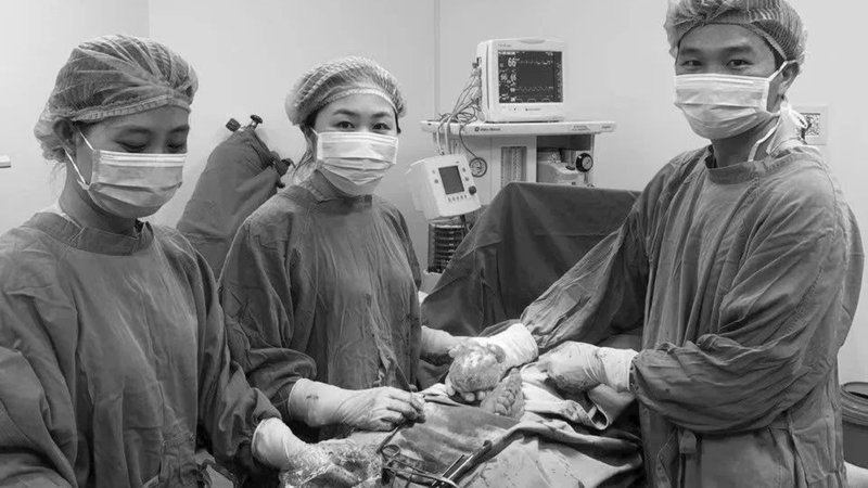 Bác sĩ phẫu thuật bóc khối u xơ tử cung kích thước khoảng 10 cm cho bệnh nhân 36 tuổi