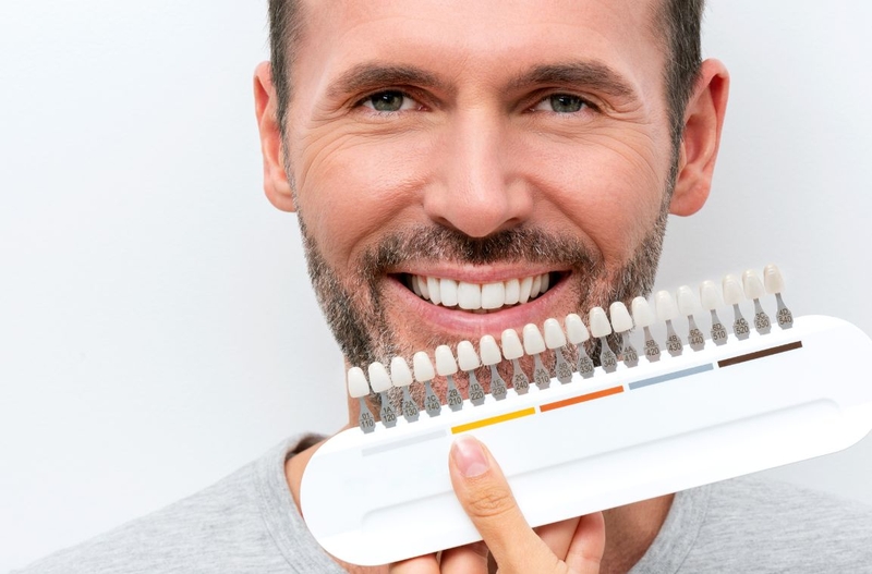 Bọc răng sứ hết bao nhiêu tiền? Bọc răng sứ giữ được bao lâu 1