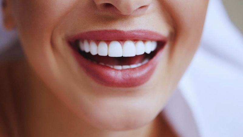 Bọc răng sứ kim loại được bao lâu? 2