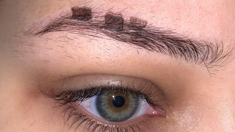 Bóc vảy lông mày sau phun có sao không? 2