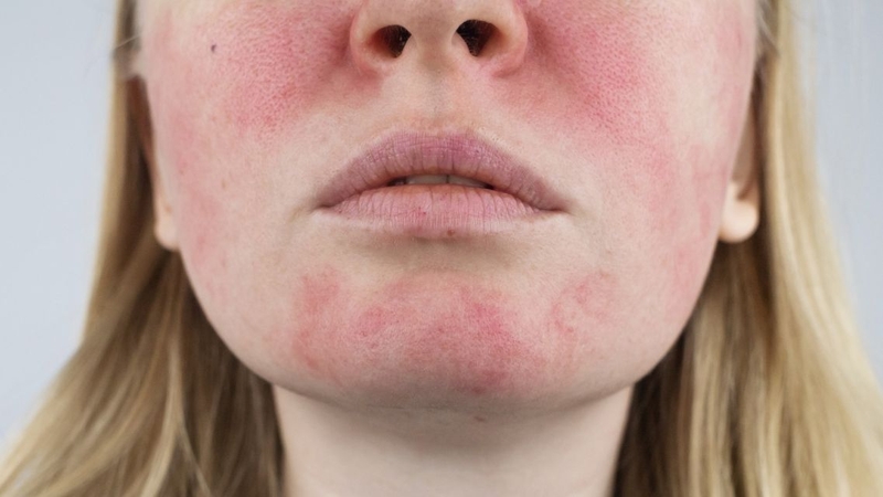 Bôi dầu oliu lên mặt hàng ngày có tốt không​ 4