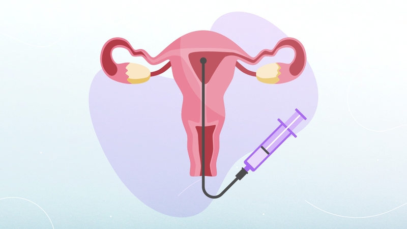 bom-iui-sau-7-ngay-co-gi-khac-khong-mot-so-dau-hieu-co-thai-sau-iui-7-ngay-ban-can-biet 2.jpg