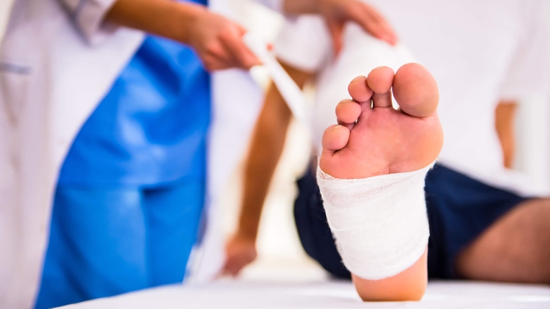 Bỏng bô xe máy bao lâu thì khỏi? Cách chữa bỏng bô xe máy 2