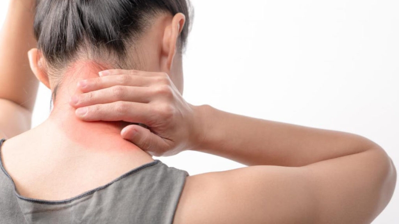 Bong gân cổ có nguy hiểm không? 1