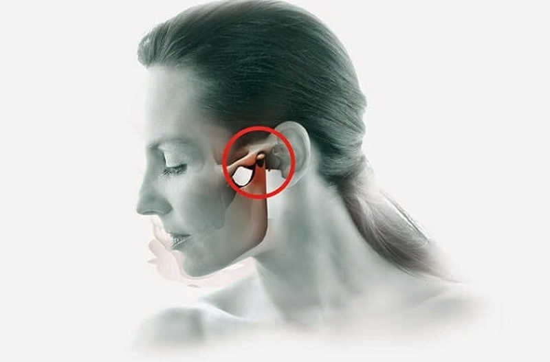 Bong gân hàm có phải sái quai hàm hay không? 1