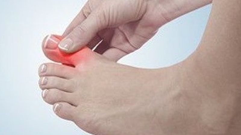 Bong gân ngón chân cái là gì? Do đâu? Xử lý như thế nào? 1