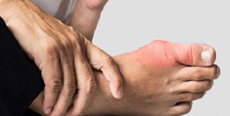 Bong gân ngón chân cái là gì? Do đâu? Xử lý như thế nào? 3