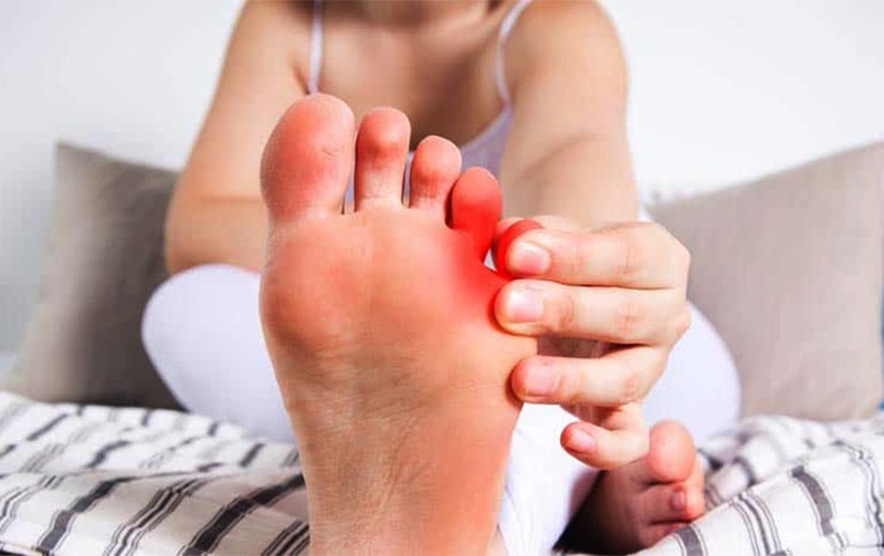 Bong gân ngón chân út: Biểu hiện, phương pháp điều trị mau khỏi nhất 2