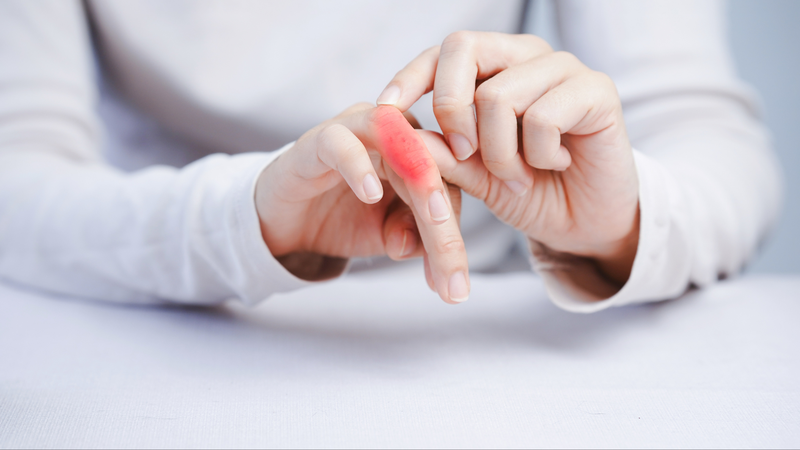 Bong gân ngón tay là chấn thương phổ biến