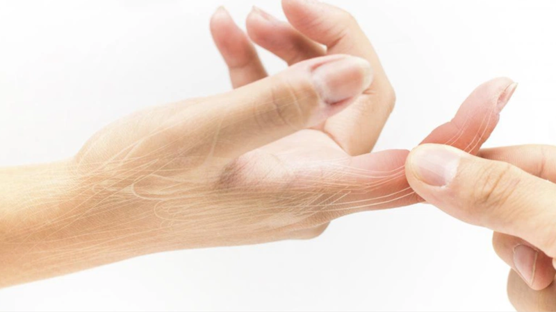 Sưng đỏ và hạn chế vận động là những biểu hiện đặc trưng nhất khi bị bong gân ngón tay