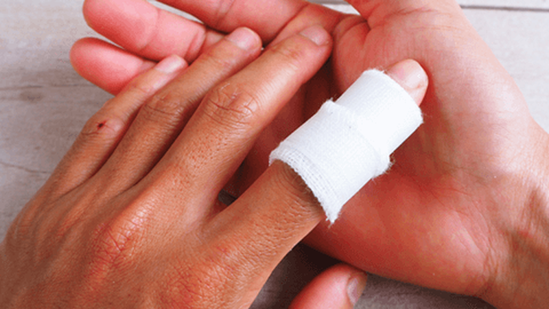 Bong gân ngón trỏ tay: dấu hiệu, nguyên nhân và cách điều trị mau khỏi  1