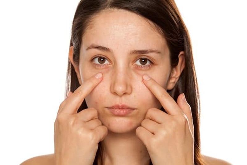 Bọng mắt nổi gân xanh có nguy hiểm không 2