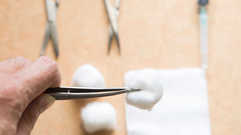 Bông tự tiêu khi nhổ răng là gì? Những điều cần biết khi sử dụng 4