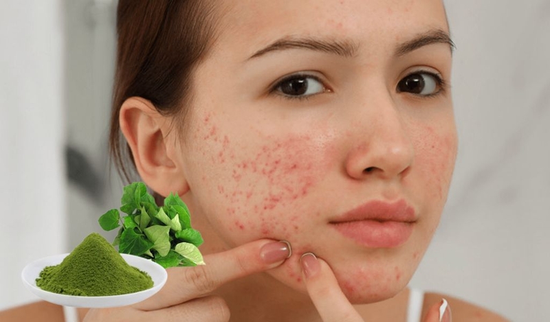 Bột diếp cá có tác dụng gì? Cách sử dụng như thế nào? 2