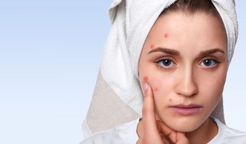 Bột diếp cá đắp mặt có tốt không? Có nên dùng hằng ngày không? 1