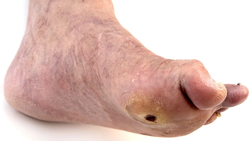 Bột Multidex Deroyal điều trị nhiễm trùng da, giảm sưng viêm và đau 2