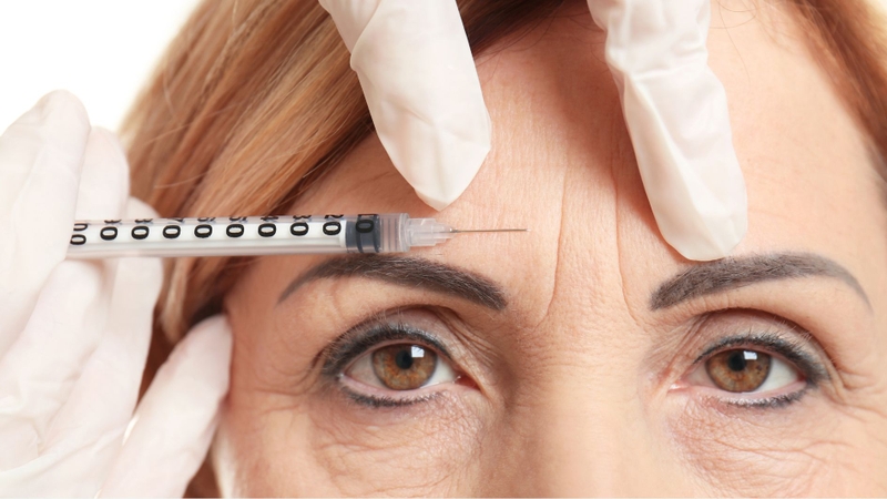 Botox thường được sử dụng trong thẩm mỹ để giảm nếp nhăn và giúp da trông trẻ hơn