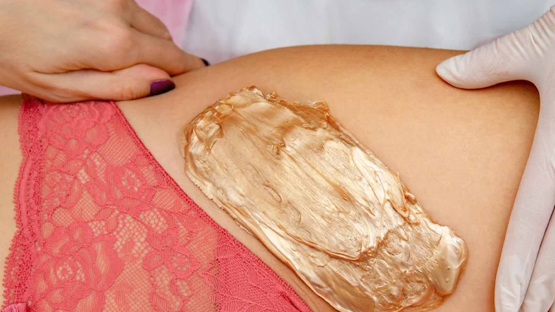 Brazilian wax là gì? Quy trình diễn ra như thế nào? 3