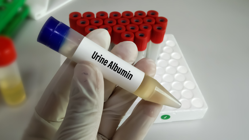 Bệnh thận đái tháo đường là gì? Cách phòng ngừa và điều trị bệnh thận đái tháo đường 5