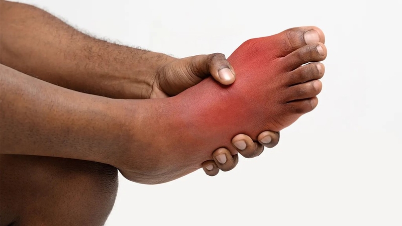 Gợi ý thực đơn bữa sáng cho người bệnh Gout 1