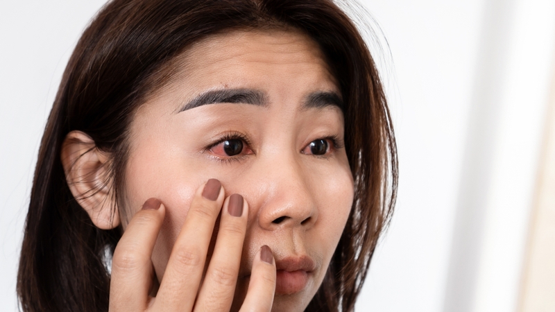 Đeo kính bảo vệ, hạn chế tiếp xúc khói bụi và chăm sóc mắt đúng cách
