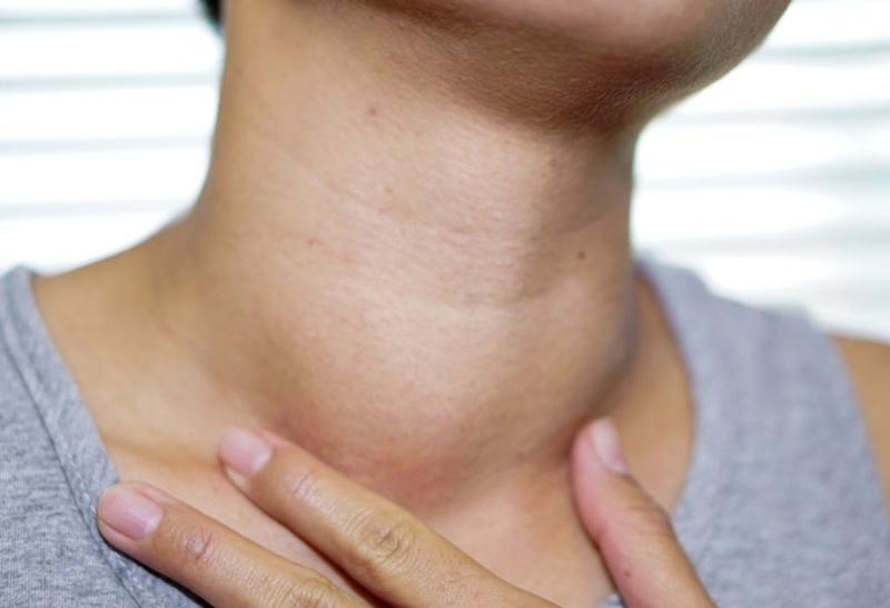 Bướu cổ ăn cải thảo được không? Thực phẩm nên ăn và nên tránh khi bị bướu cổ 1