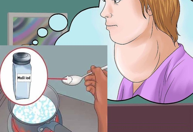 Bướu cổ ăn củ cải trắng được không? Bướu cổ ăn gì tốt? 2