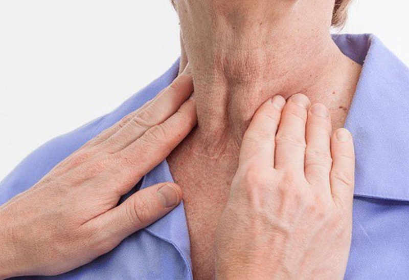 Bướu cổ basedow có lây không? Nguyên nhân, biểu hiện và cách điều trị đúng 2
