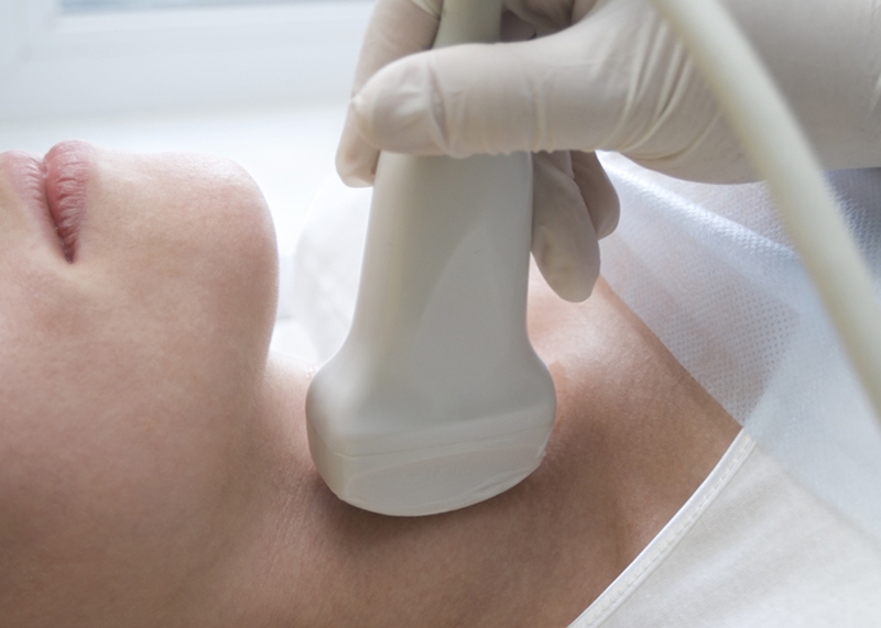 bướu cổ dạng nhân 1