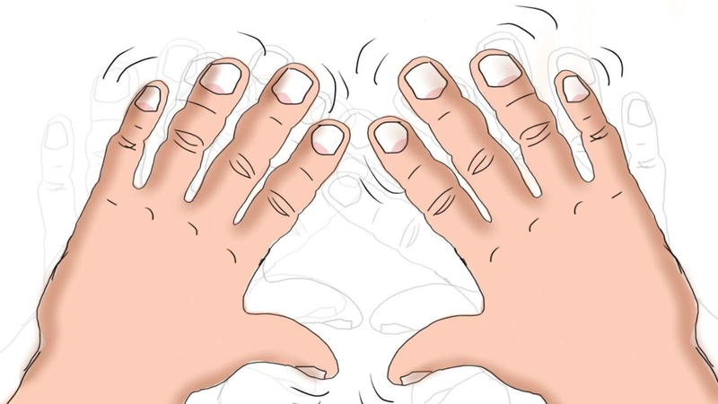 Bướu giáp nhân là gì? Nguyên nhân, triệu chứng và cách điều trị 4