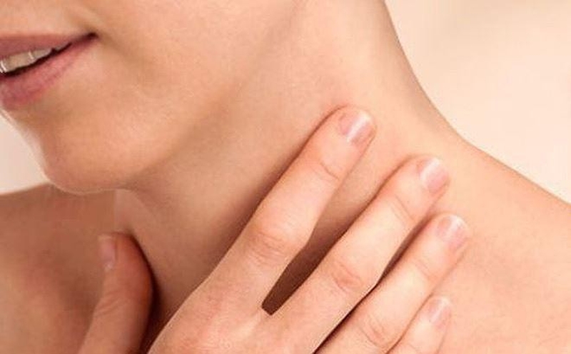 Bướu giáp nhân 2 thùy: Bướu cổ hai bên 1