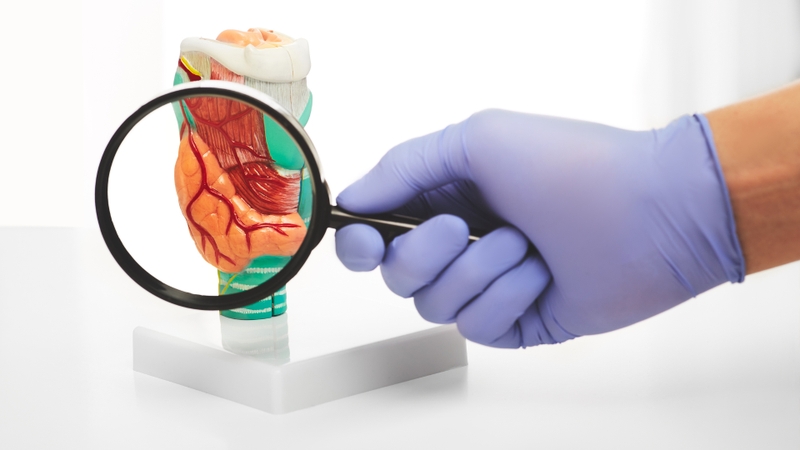 Bướu giáp thòng là gì? Nguyên nhân và phương pháp điều trị hiệu quả 2